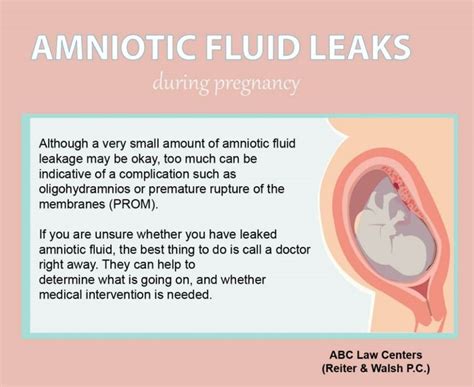 does leaking amniotic fluid smell|Signs Of Leaking Amniotic Fluid Vs. Discharge: The Difference